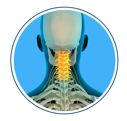 Cervical Spine (Neck) Procedures